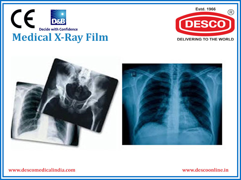 Medical X-Ray Film